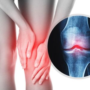 Tìm hiểu TẤT TẦN TẬT về bệnh xương khớp thường gặp